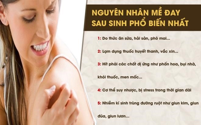 Nổi mẩn ngứa mề đay sau sinh