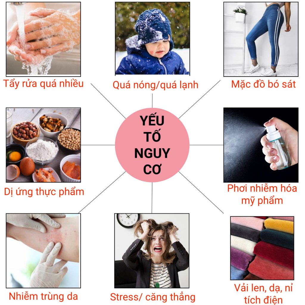 Viêm da cơ địa ở người lớn