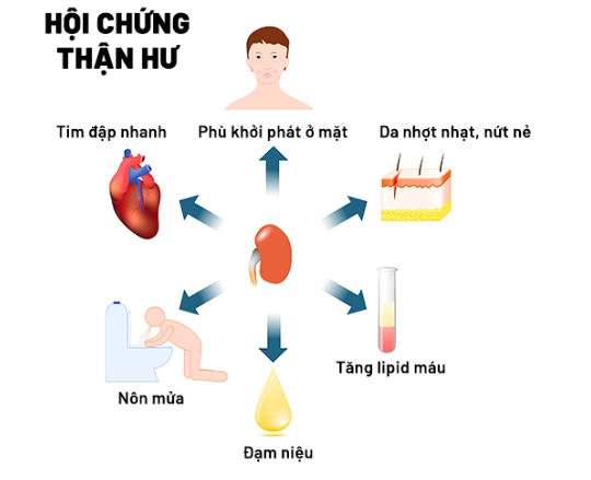 Biến chứng bệnh thận do viêm mao mạch dị ứng