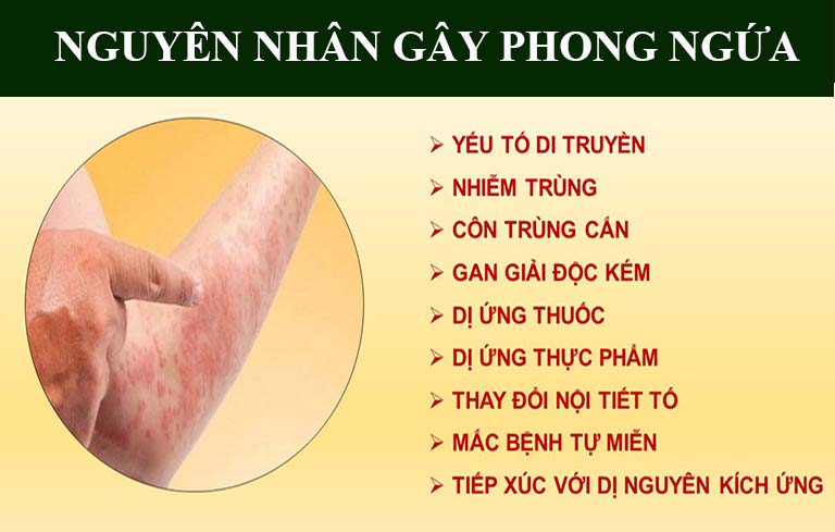 Phong ngứa