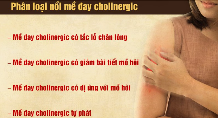 Bệnh mề đay Cholinergic