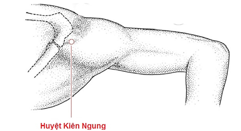 Bấm huyệt chữa mẩn ngứa mề đay