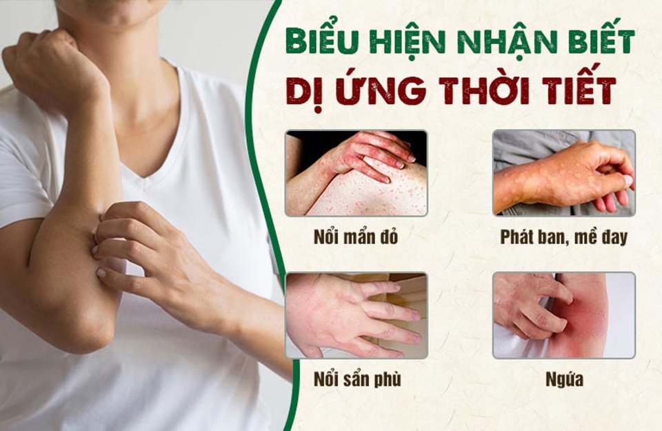 chữa dị ứng thời tiết theo Đông y