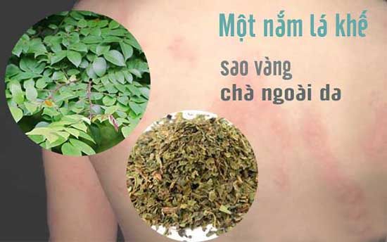 cách chữa mẩn ngứa mề đay bằng lá khế